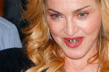 Мадонна шокировала фанатов своими зубами. Фото