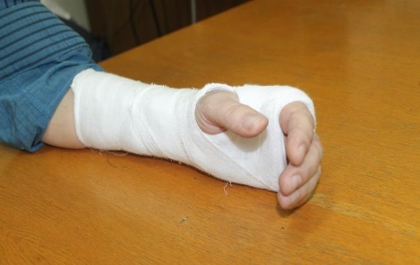 В Херсонской области помощник нардепа сломал руку редактору