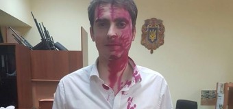 Советника мэра Киева облили марганцовкой. Фото