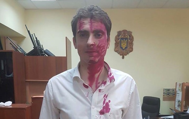 Советника мэра Киева облили марганцовкой. Фото