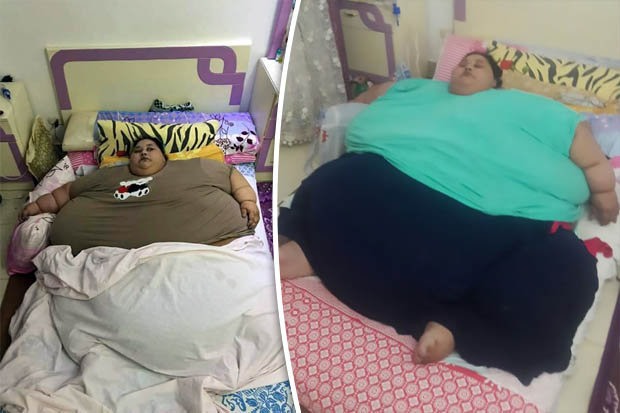 Самая тяжелая женщина на планете похудела на 140 кг. Фото